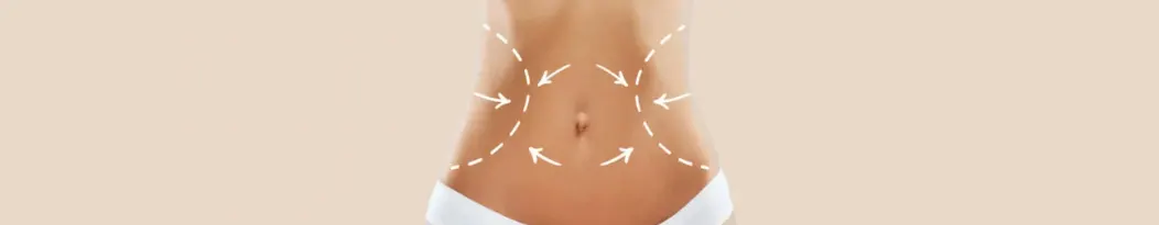 Abdominoplastie Tunisie